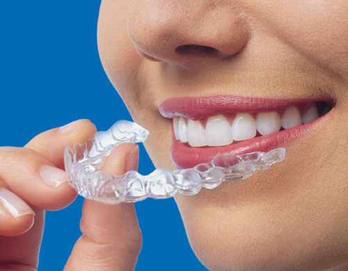 BEST INVISALIGN CLINIC IN CHENNAI